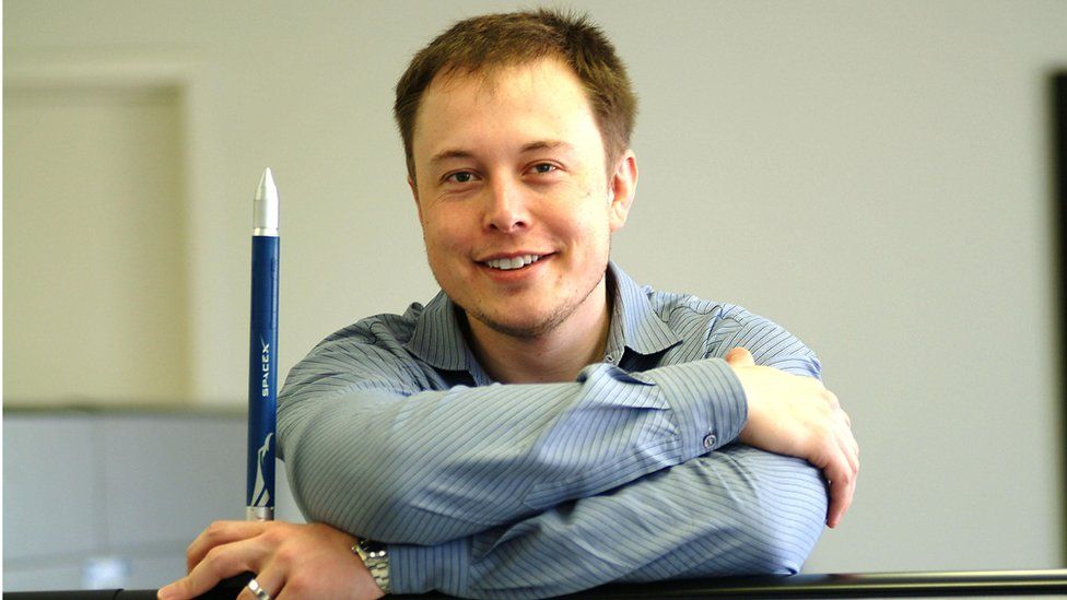 Elon Musk before the second hair transplsnt