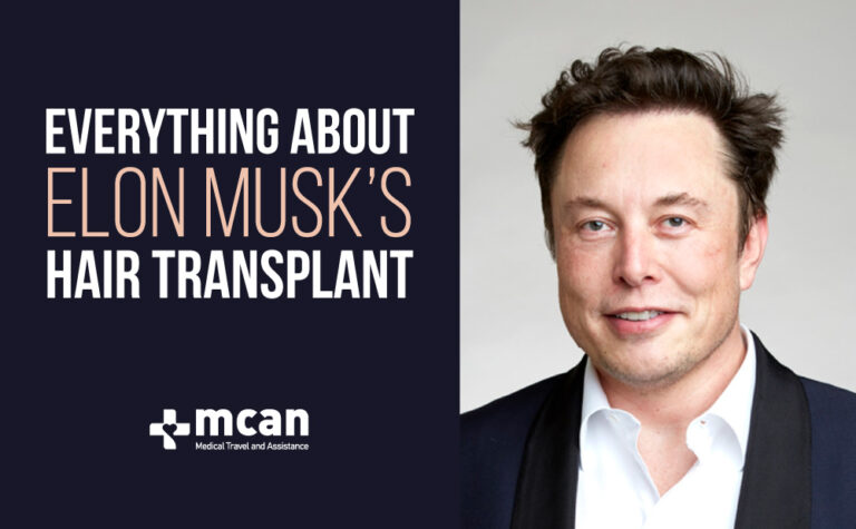 Everything About Elon Musk Hair Transplant