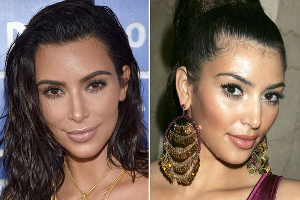 kim kardashian plastic surgery before and after