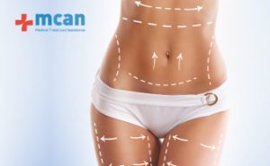Tummy Tuck and Liposuction in Turkey blog