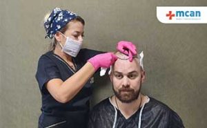 hair transplant procedure