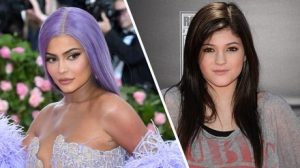 kylie jenner before after