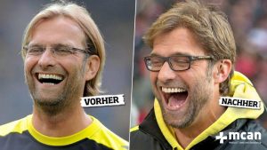 Jurgen Klopp Haartransplantation Mcan Health