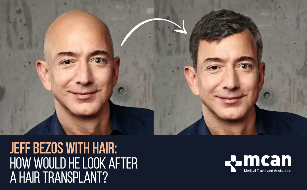 Jeff Bezos with Hair Photos Rummers and Stories