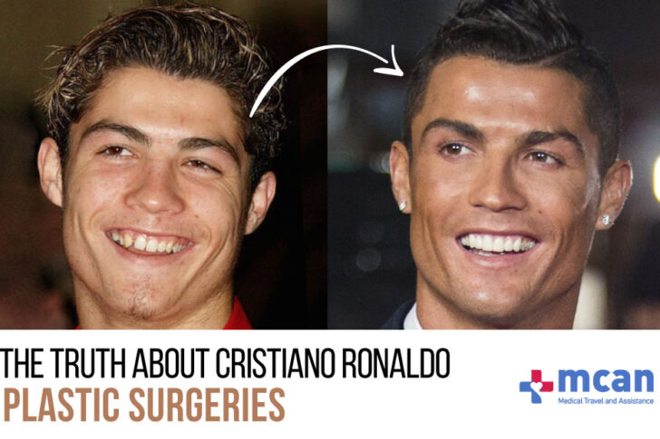 The Truth About Cristiano Ronaldo Plastic Surgeries