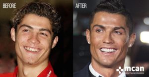 The Truth About Cristiano Ronaldo Plastic Surgeries!