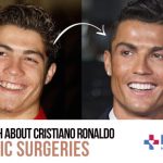 The Truth About Cristiano Ronaldo Plastic Surgeries