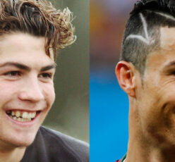 The Truth About Cristiano Ronaldo Plastic Surgeries