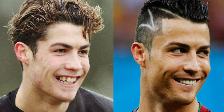 The Truth About Cristiano Ronaldo Plastic Surgeries