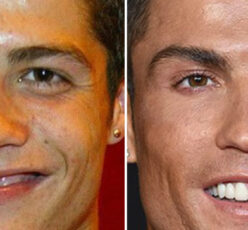 The Truth About Cristiano Ronaldo Plastic Surgeries