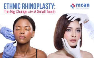 ETHNIC RHINOPLASTY BLOGG COVER