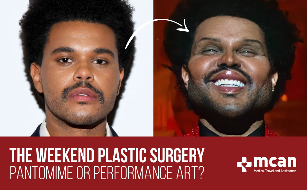 The Weekend Plastic Surgery; True or False?