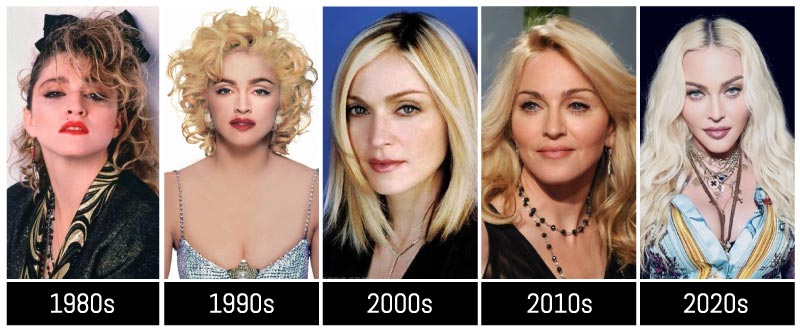 Did Madonna Get Plastic Surgery? Transformation Photos