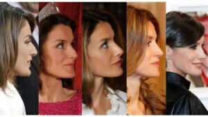 Reina Letizia antes y después de su rinoplastia