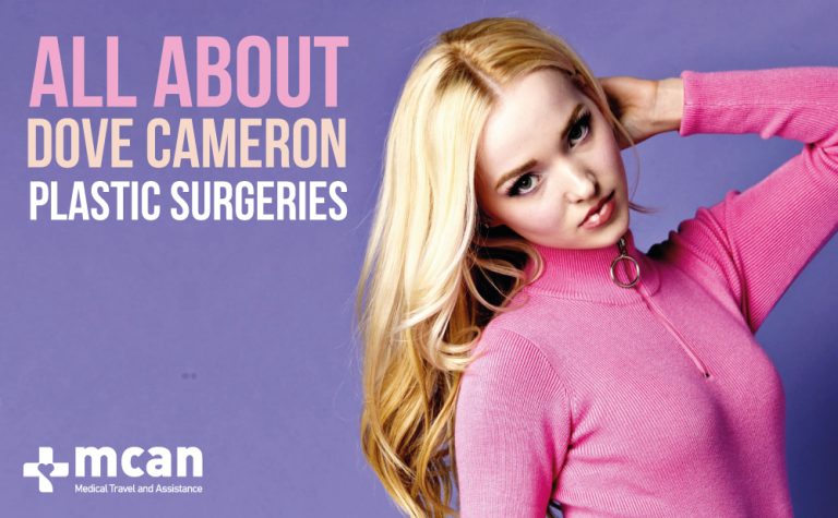Dove Cameron Plastic Surgery Before And After With Pics My Xxx Hot Girl