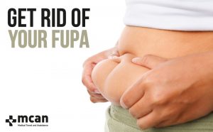 What is fupa