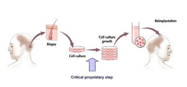 clonacion capilar proceso