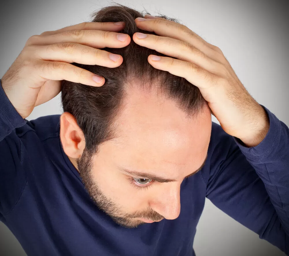 hair loss in the hairline 