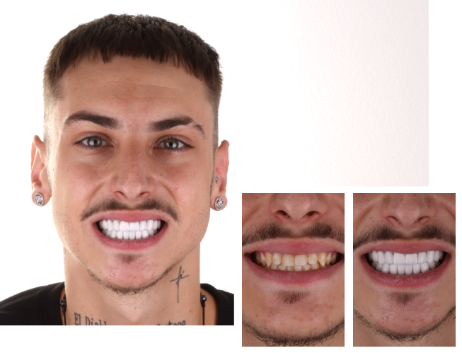 Dentistry Before After Banner