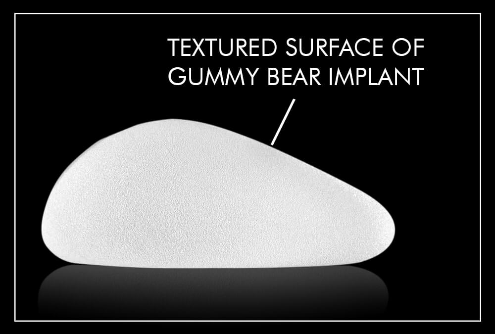 gummy bear breast implant 