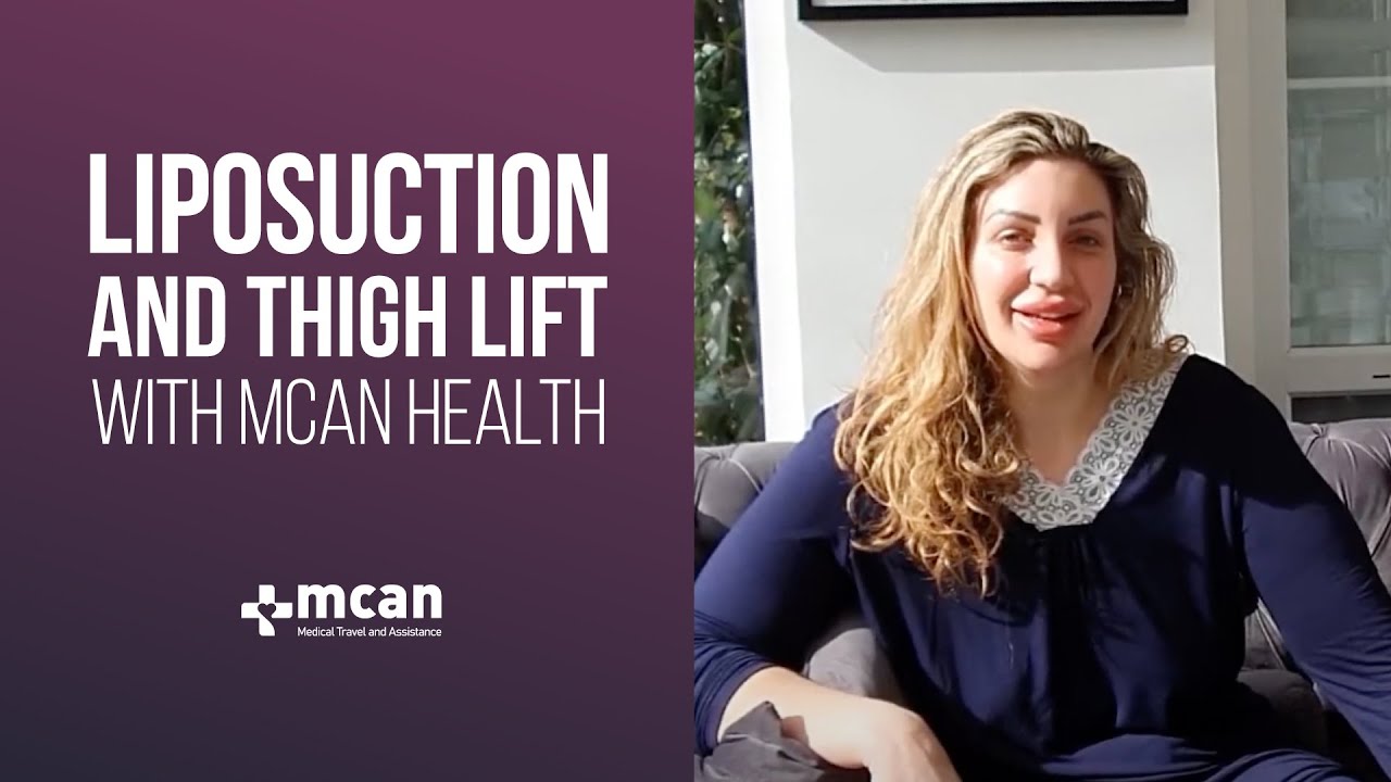 Thigh Lift and Liposuction Turkey with MCAN Health