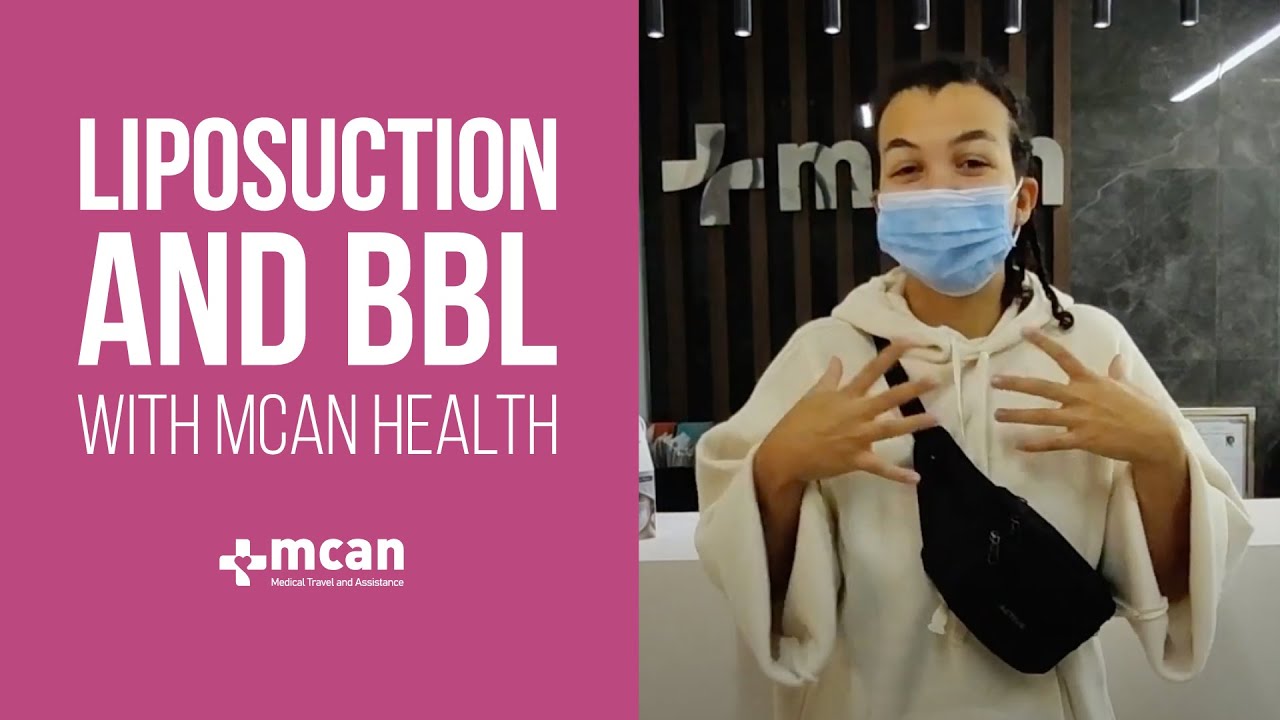 Liposuction and BBL Experience of Gabriella in Turkey with MCAN Health!