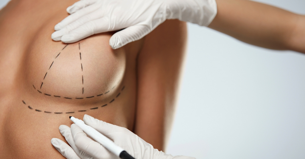 breast augmentation measuring