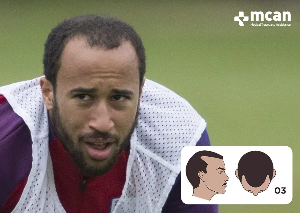 Andros Townsend Norwood