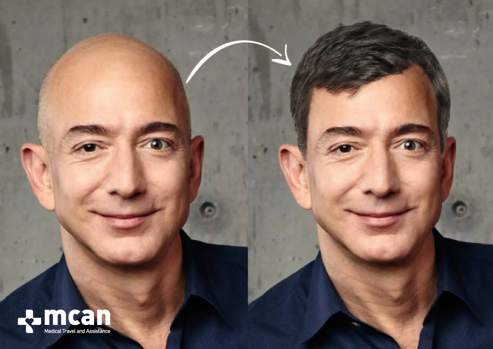 How Jeff Bezos Look Like with Hair