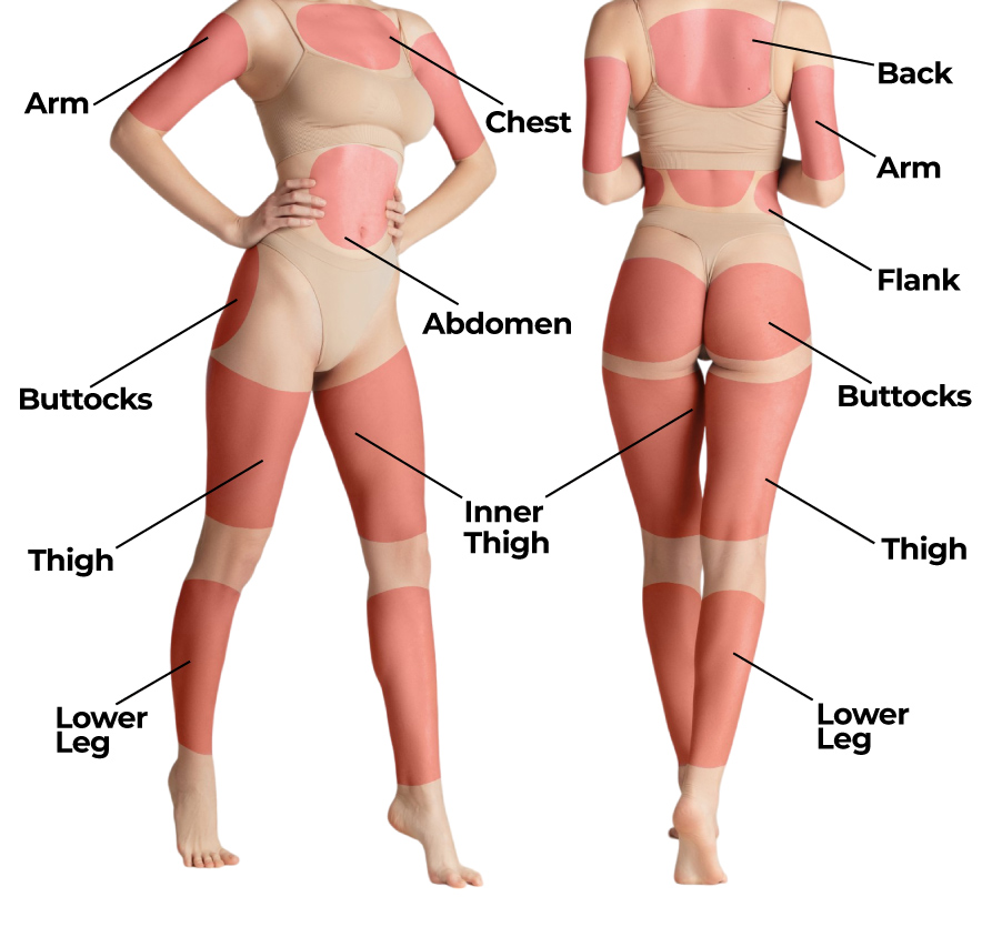 Where can Liposuction be Performed