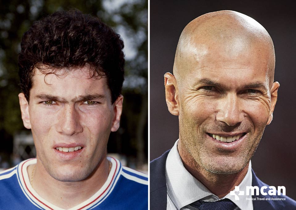 Young Zidane vs Charisma Zidane