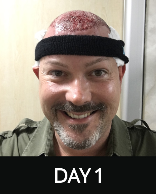 DAY 1