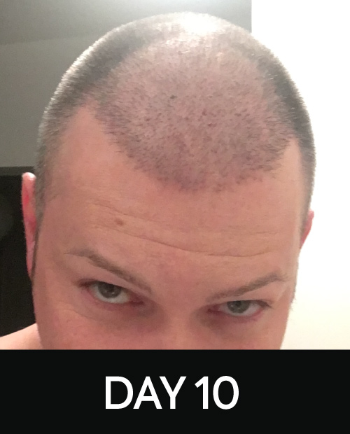 DAY 10