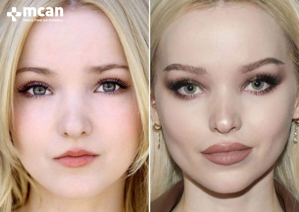 Dove Cameron