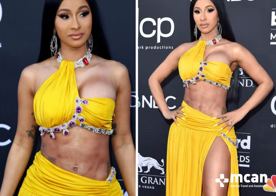 cardi b lipo