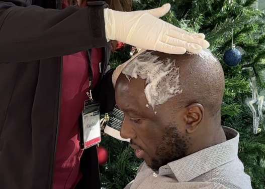 Afro Hair Transplant Aftercare